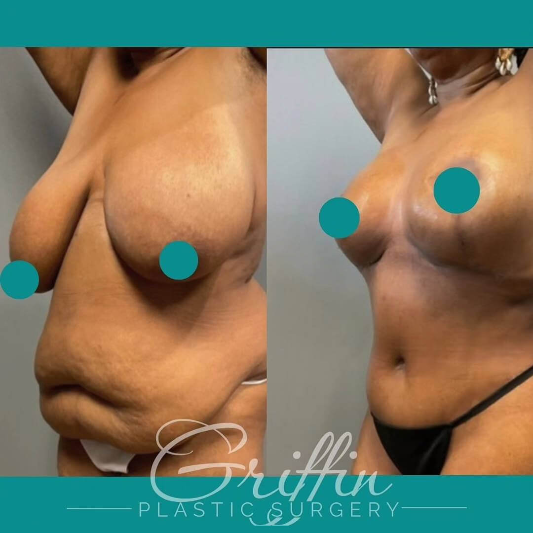 dr griffin before after 1