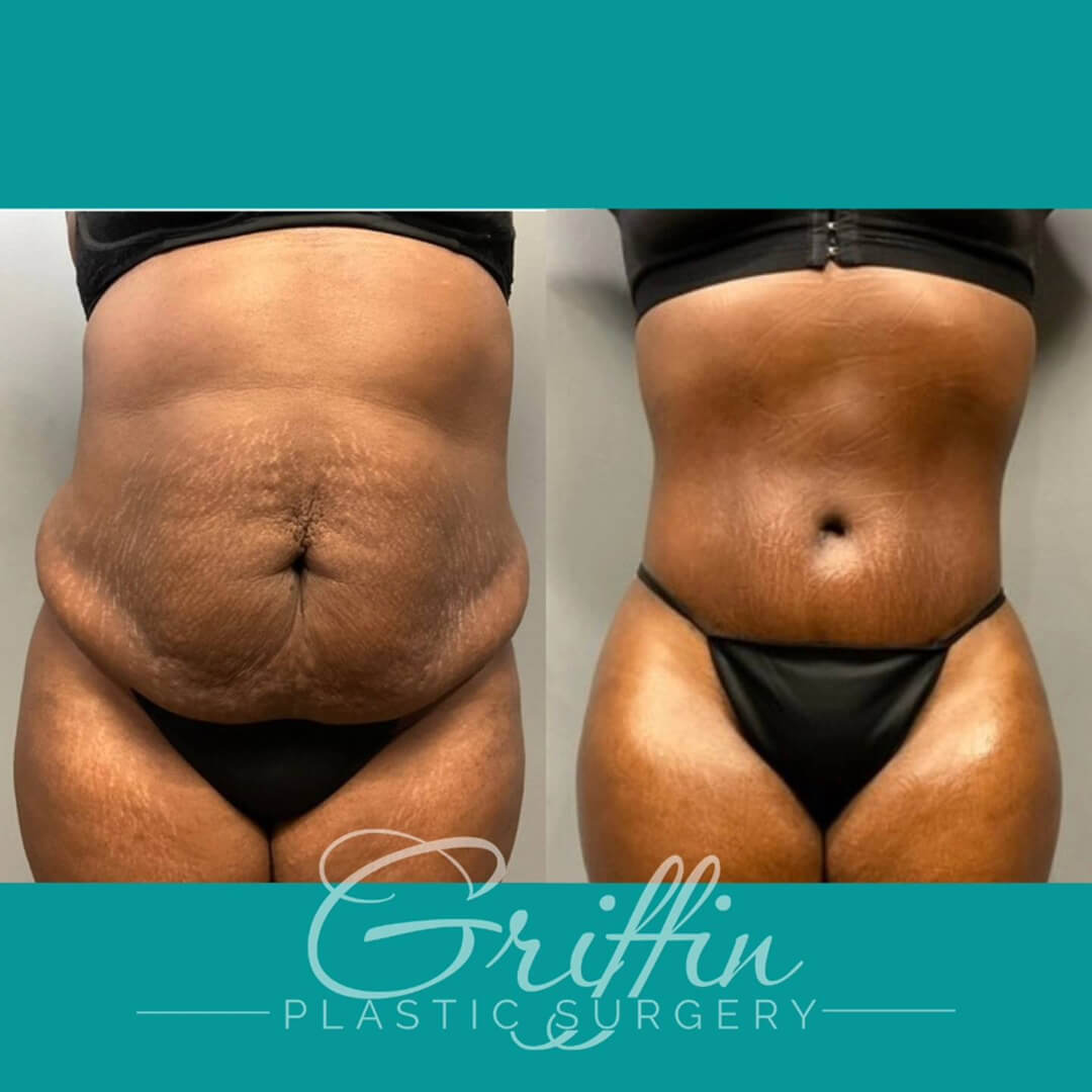 dr griffin before after 2