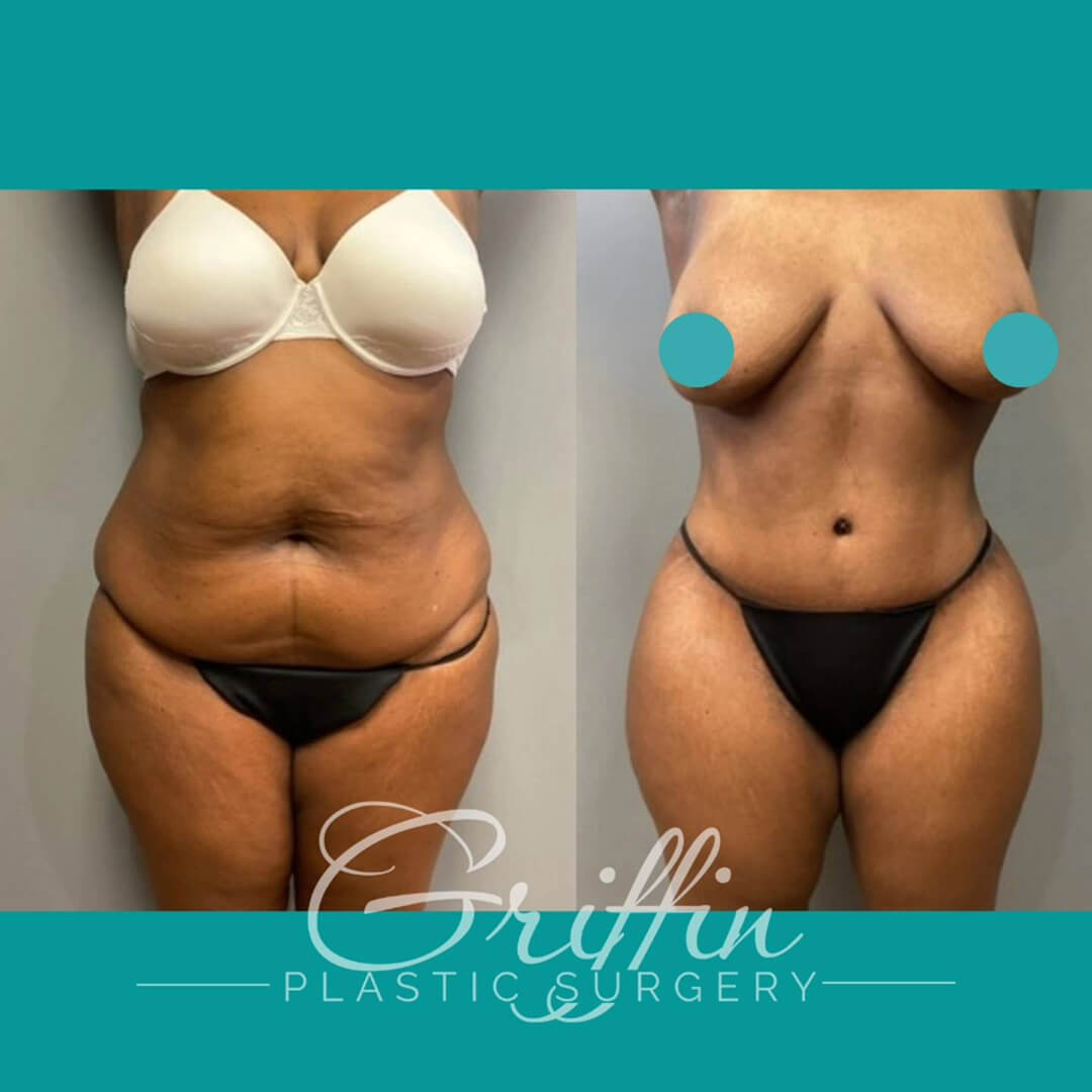 dr griffin before after 3