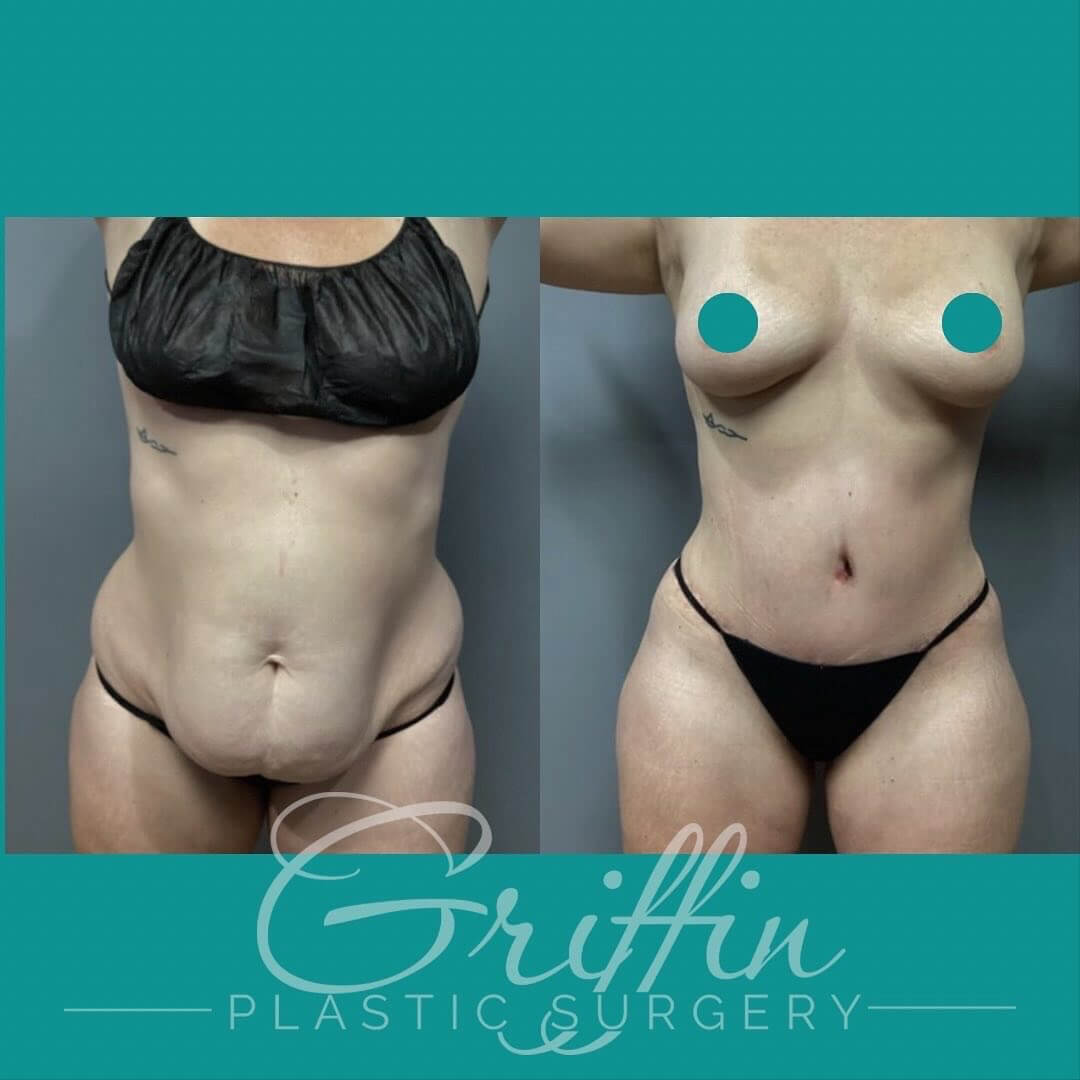 dr griffin before after 5