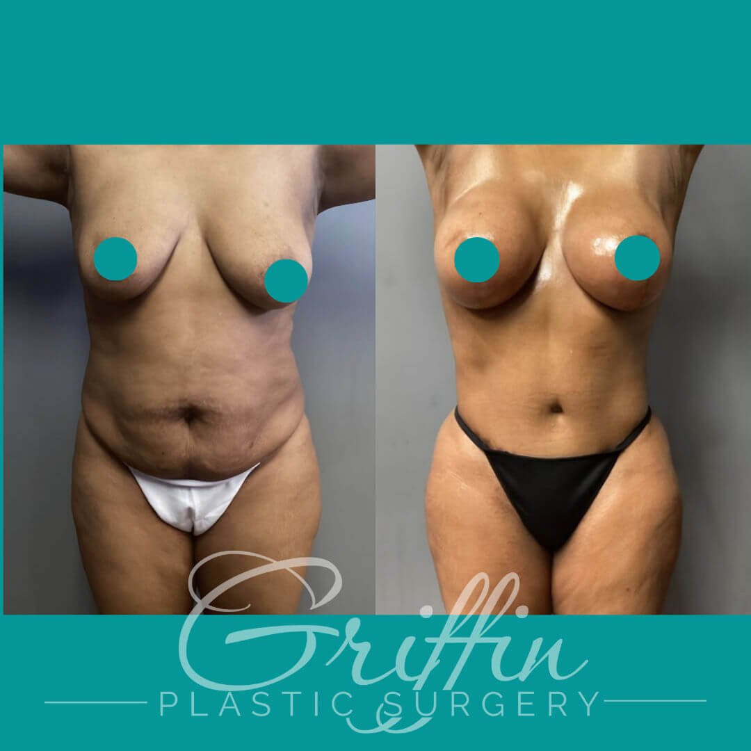 dr griffin before after 6